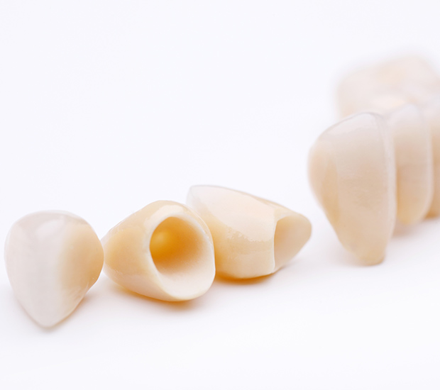 Nacogdoches Dental Crowns and Dental Bridges