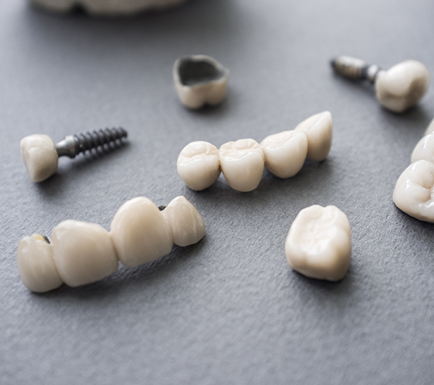 Nacogdoches The Difference Between Dental Implants and Mini Dental Implants