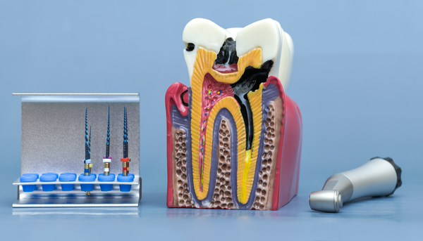 Root Canals Explained: What Patients Should Know Before Treatment