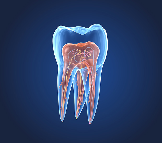 Nacogdoches What is an Endodontist
